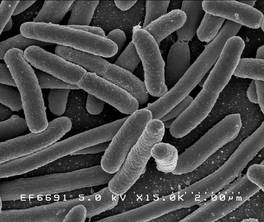 Rezisztens baktériumot találtak a Rióban