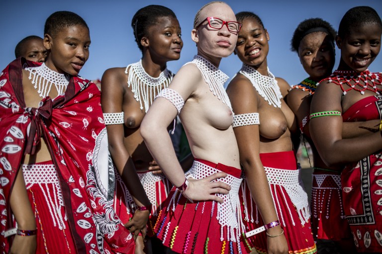 Betiltották a boszorkányságot az albínók védelmében Tanzániában