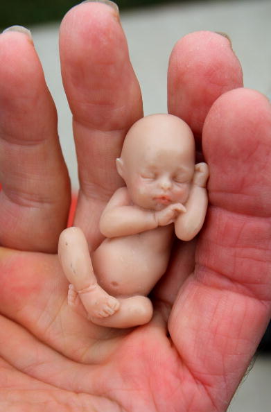 Nem tiltják be a kései abortuszt az Egyesült Államokban