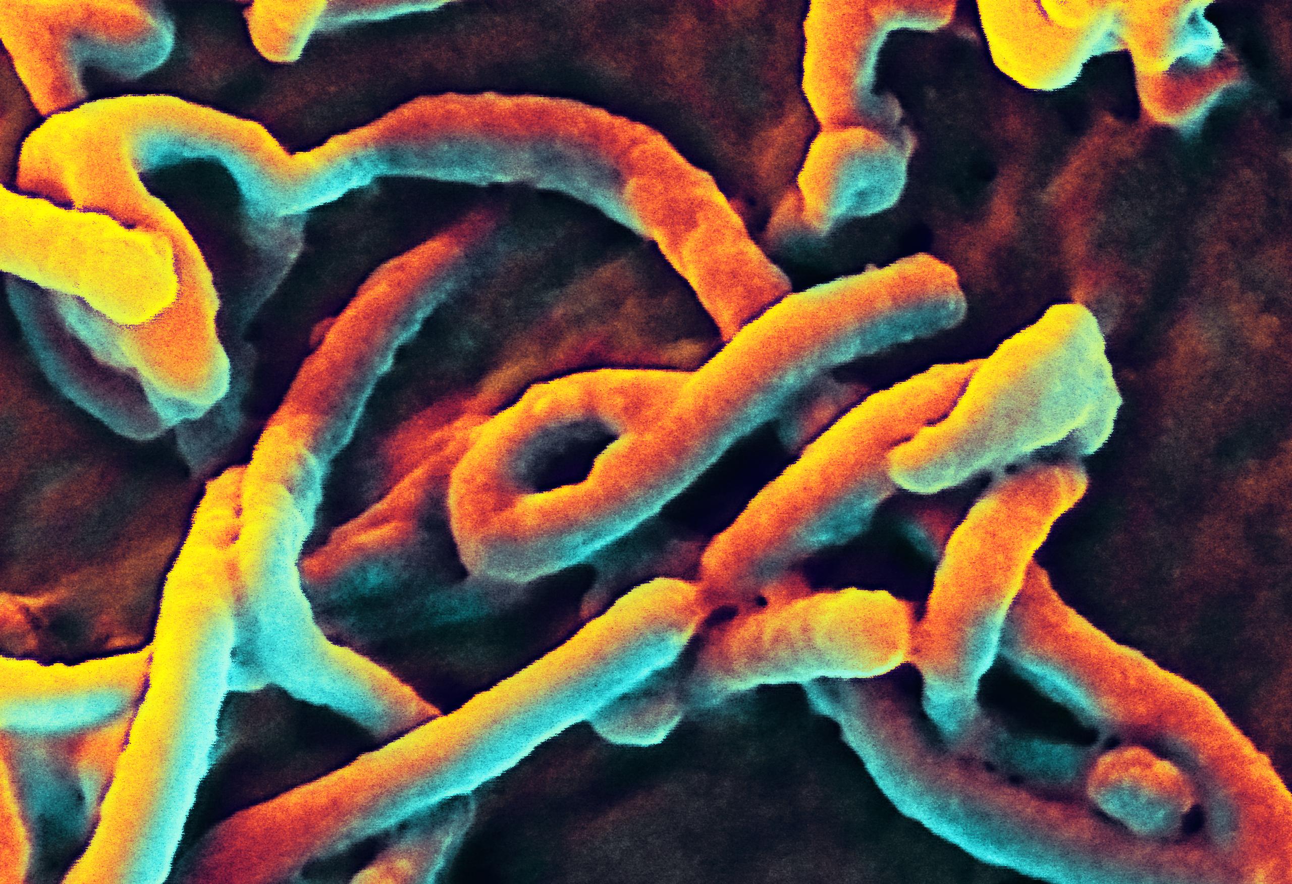 Ebolajárvány a Kalifátusban?