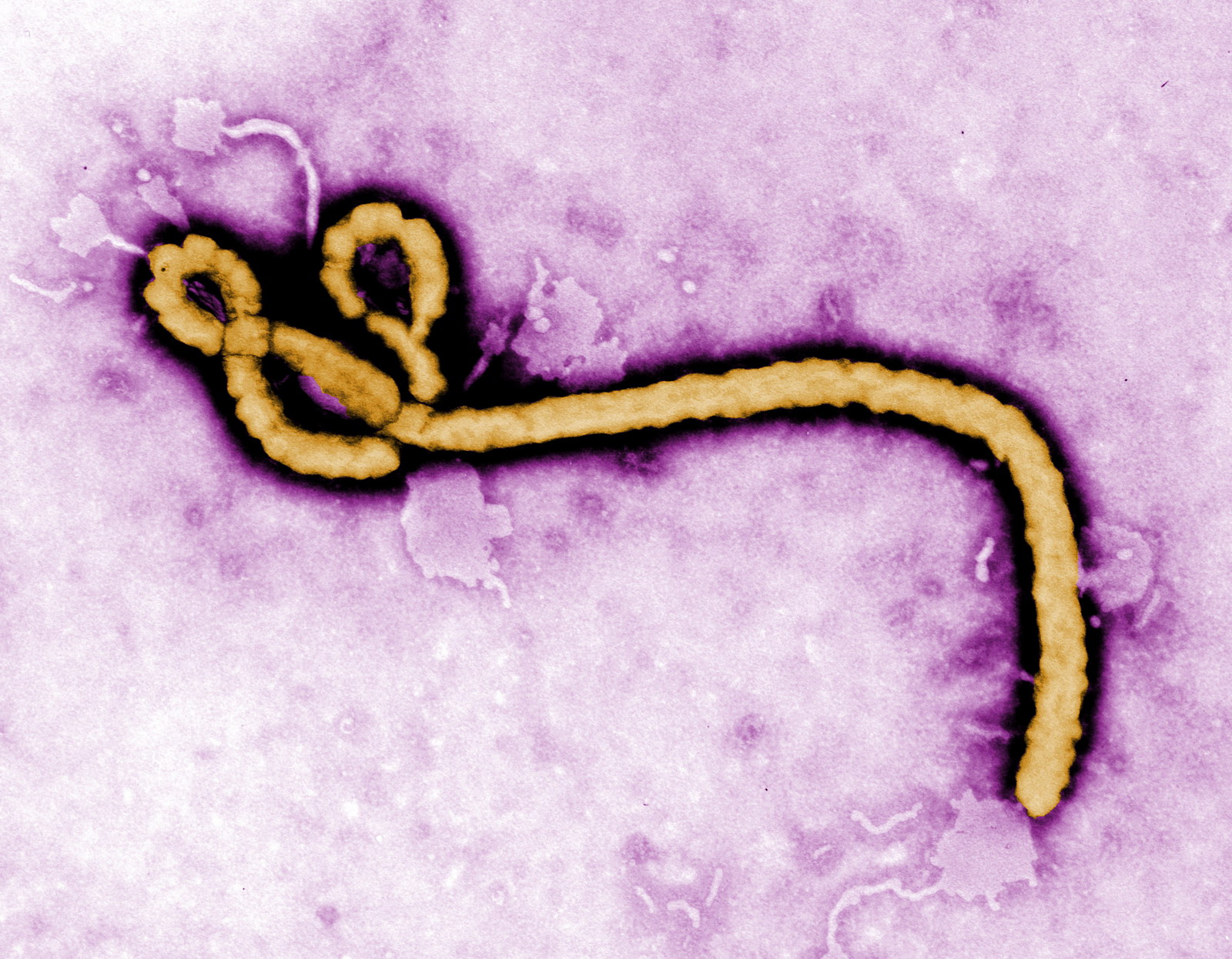 Ebolapánik Észak Koreában