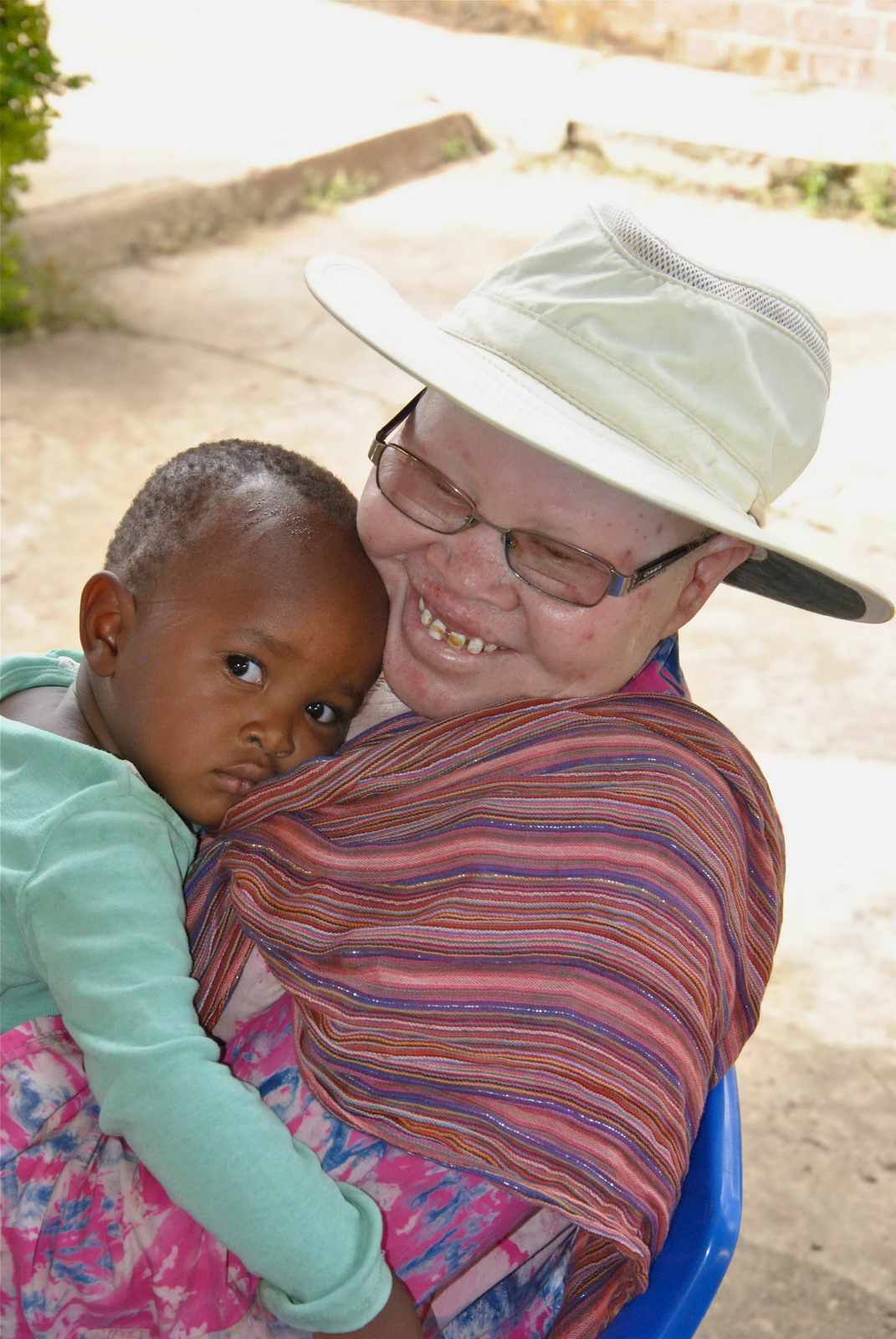 Martha Nővér, a tanzániai albínó nők és gyermekek védelmezője