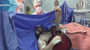 Beatles számokat gitározott agyműtétje közben egy brazil férfi
