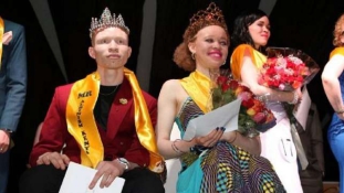 Egzotikus szépségverseny, albínóknak