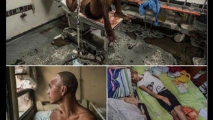 Elvérzett az egészségügyi rendszer Venezuelában