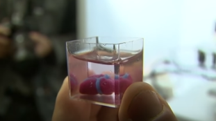 Áttörés: 3D nyomtatással, emberi szövetből készült szívet mutattak be Tel-Avivban