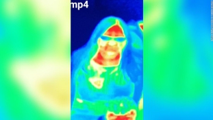 Egy múzeumi hőérzékelő vette észre a mellrákot egy brit anyukánál